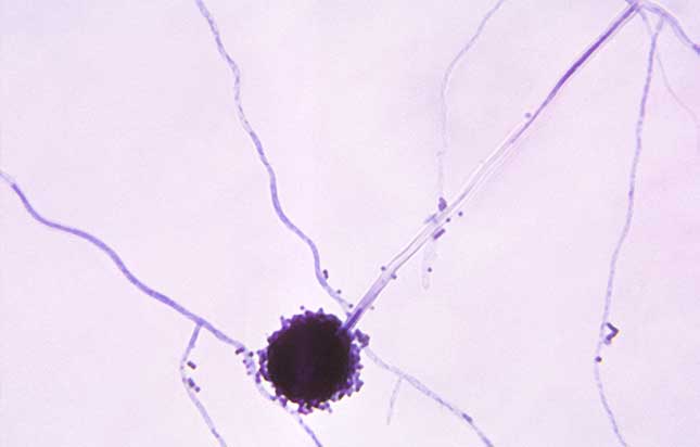 aspergillus mould